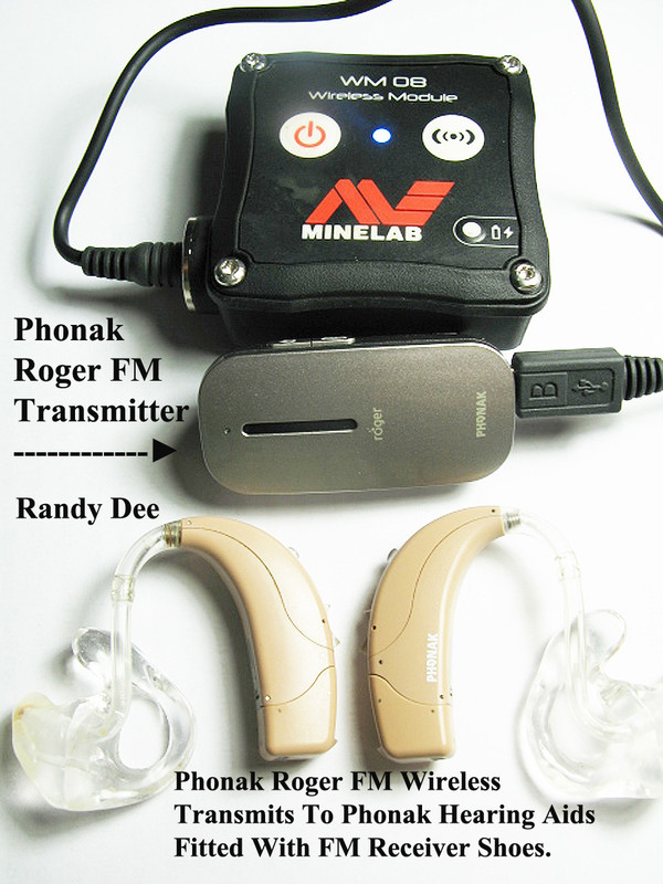 Phonak Hearing Aids & Phonak Roger Transmitter Use For Equinox ( 6 ).jpg